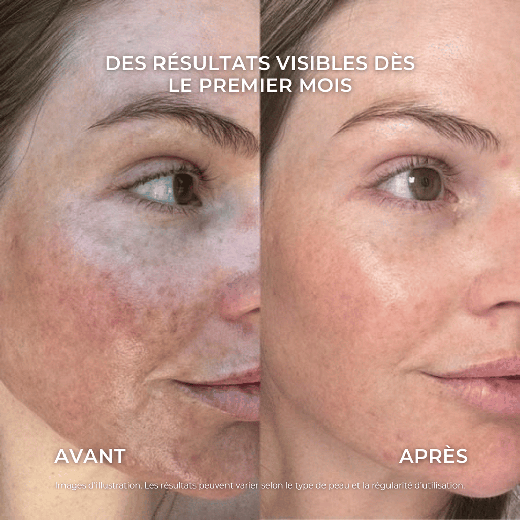 Crème hydratante anti-imperfections